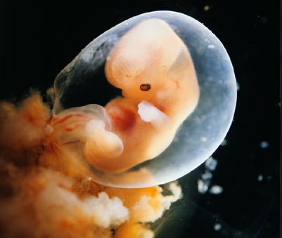 6 weeks pregnant