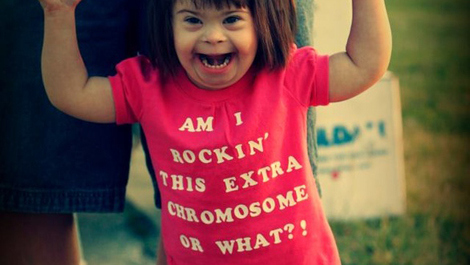 rockin a extra chromosome